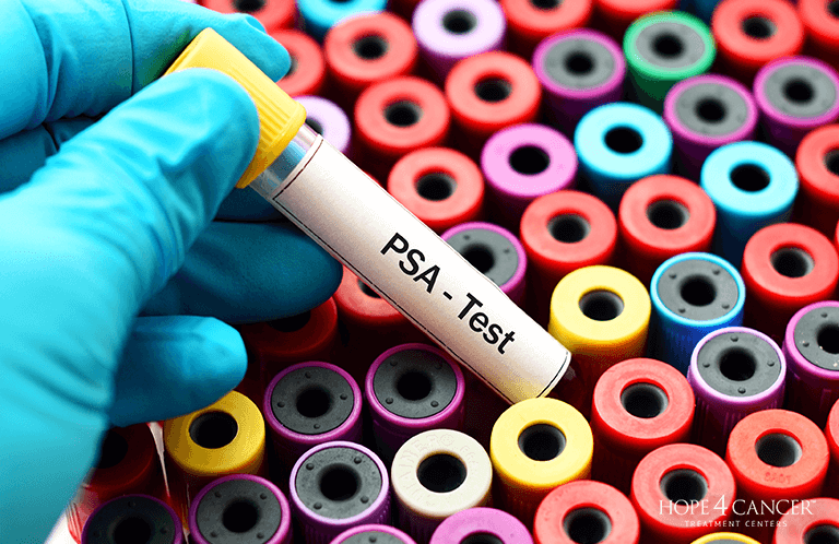 Lab Test Tubes Labeled PSA Test