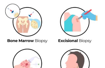 Risks and Benefits of Biopsies