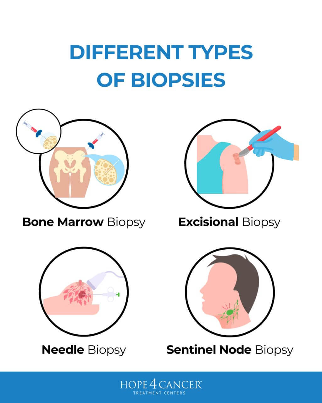 Risks and Benefits of Biopsies