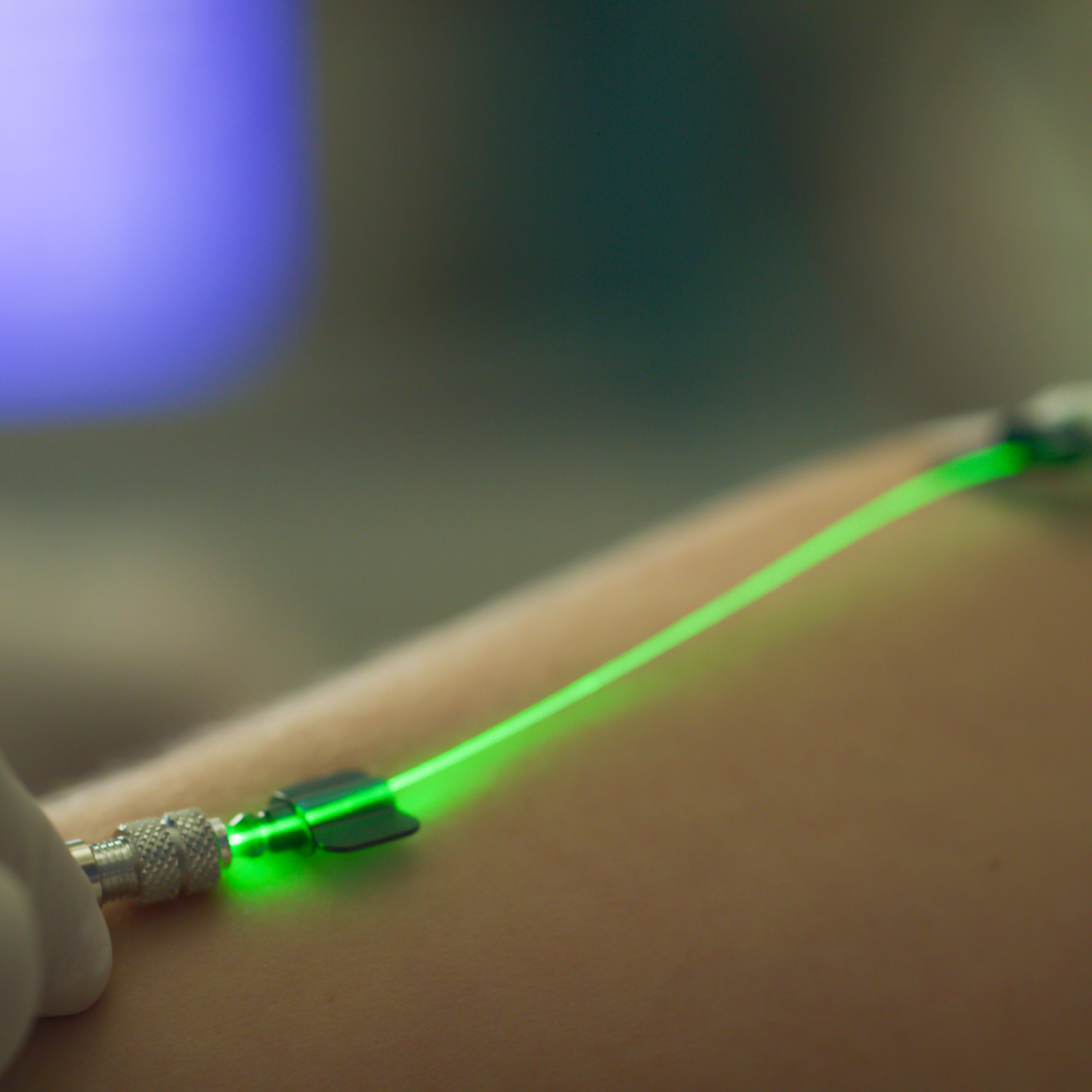 A patient receiving photodynamic therapy through green light